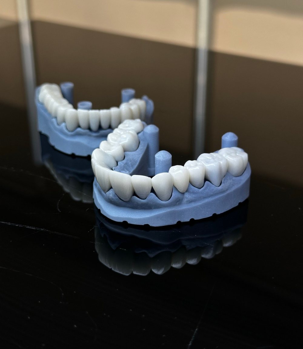 Corone in zirconia