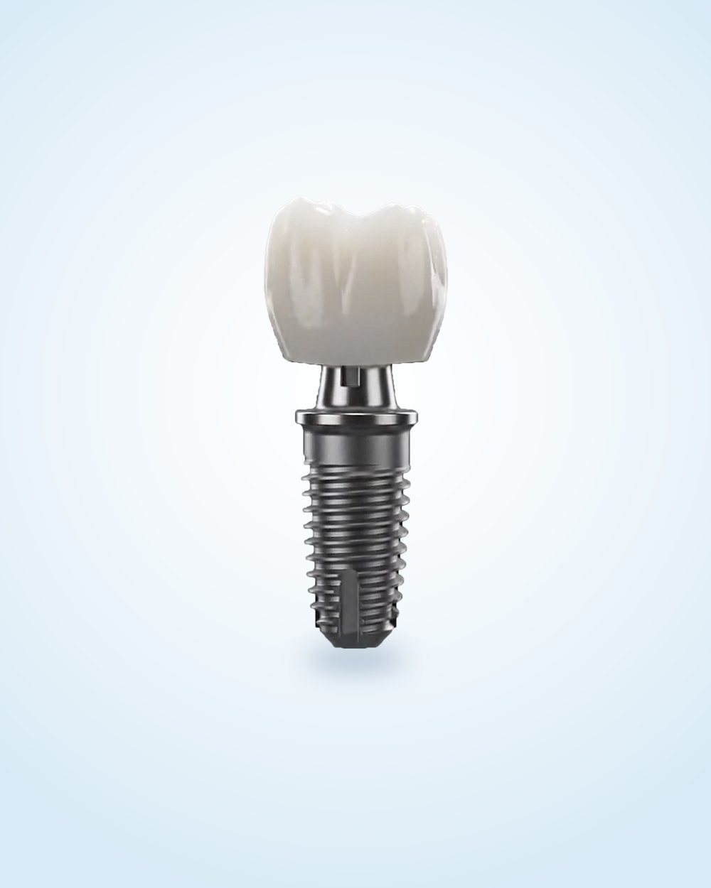 Impianti dentali